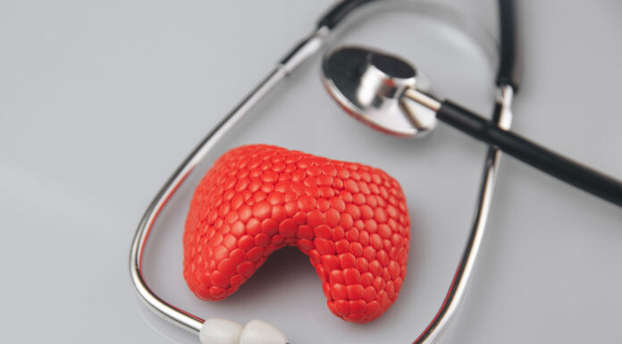 O que você deve saber sobre a tireoidite de Hashimoto?