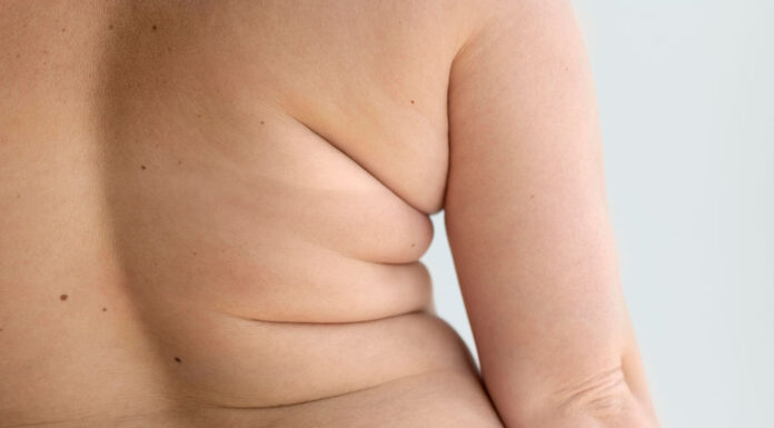 Apenas a reposição hormonal basta para emagrecer?