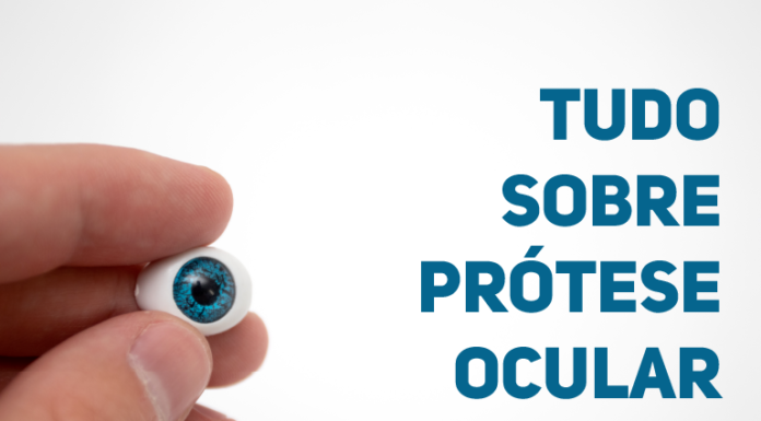 Tudo sobre prótese ocular – Centro Oftalmológico de Minas GeraisCentro Oftalmológico de Minas Gerais