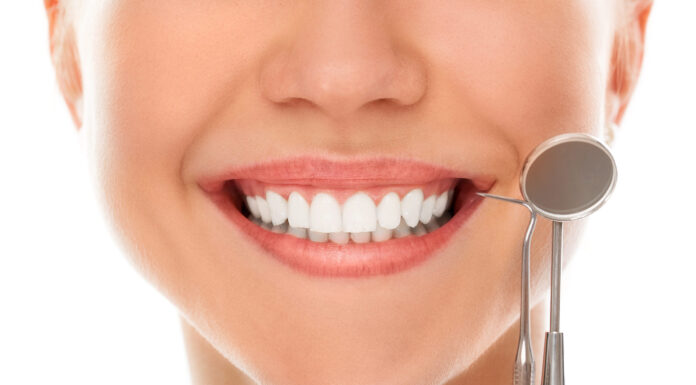 Saiba tudo sobre Clareamento Dental | OdontoBusca – Onde pacientes e dentistas se conectam