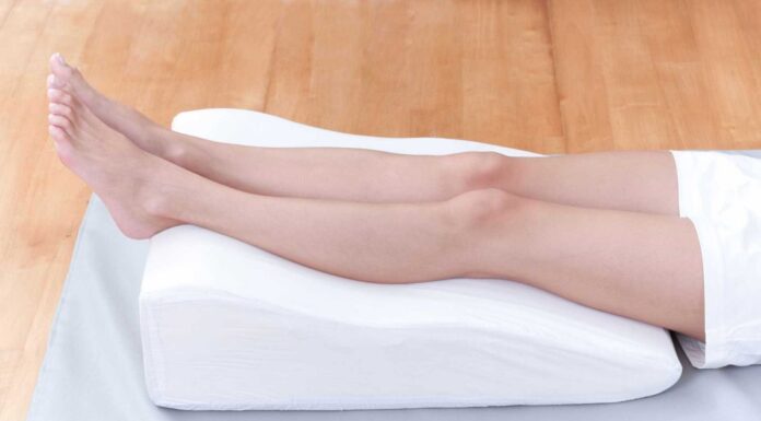 Como dormir após uma cirurgia de varizes?