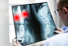 Exames de Raio X Ortopédico