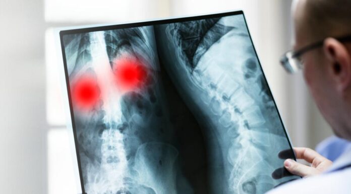 Exames de Raio X Ortopédico
