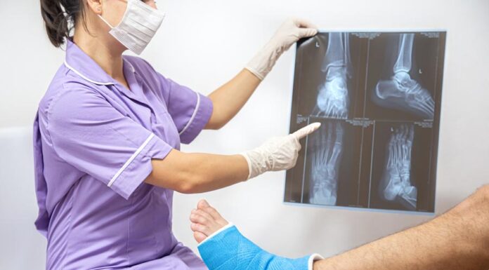 Raio X Ortopédico: Consulta e Exame de Imediato