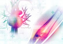 Cateterismo Cardíaco