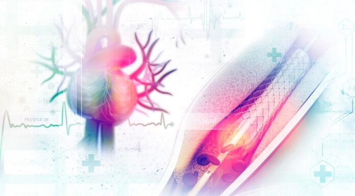 Cateterismo Cardíaco